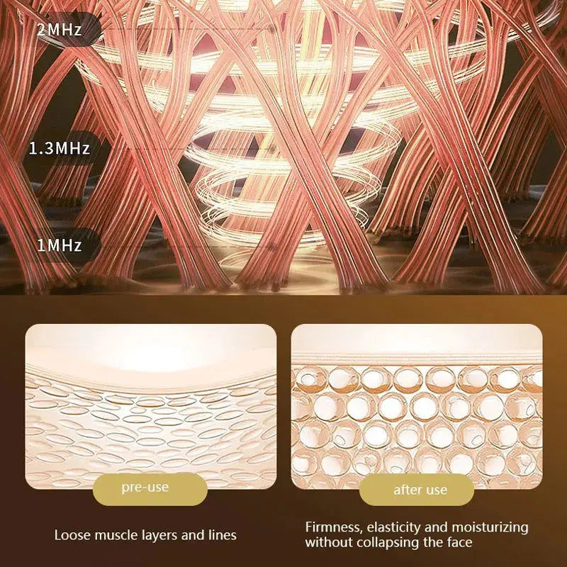 Neck & Facial Lifting™ - Glow roots 